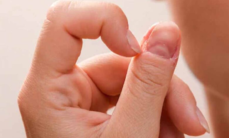 नाखूनों के ये संकेत न करे अनदेखा, नहीं तो पहुंच सकते हैं अस्पताल