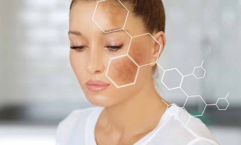 त्वचा को कालेपन से बचाने के लिए अपनाए ये आसान तरीके – Khabar Jagat