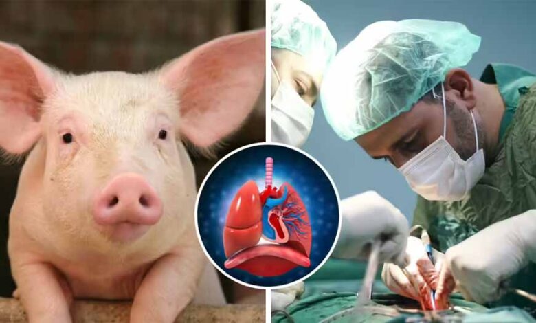 ब्रेन डेड मरीज पर पहली बार सूअर का फेफड़ा लगाया गया, साइंस ने कर दिखाया करिश्मा