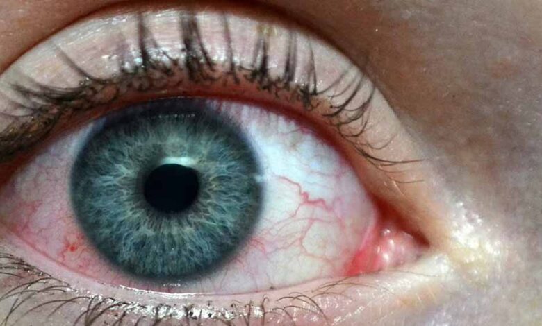 आंखों की जांच से सिर्फ नजर नहीं, जानलेवा कैंसर की भी होगी पहचान