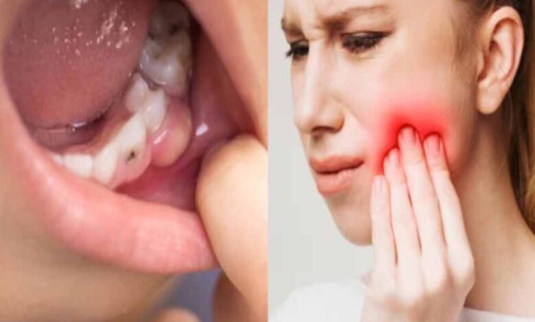 दांतों को ठंडा गर्म लगने से बचाने के उपाय – Khabar Jagat