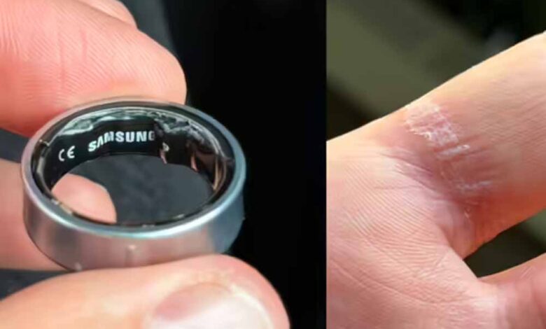 एयरपोर्ट पर रोका गया यात्री, पहुंचा अस्‍पताल – Khabar Jagat