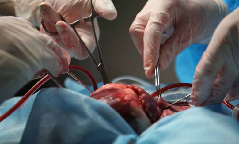 पहला ट्रांसप्लांट जिसने दुनिया को हिला दिया! – Khabar Jagat