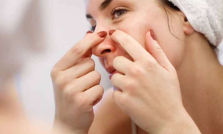 पिंपल्स फोड़ना पड़ सकता है भारी, चेहरा खराब होने और इन्फेक्शन का बढ़ता है खतरा